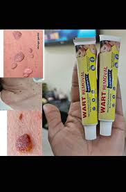 Crema Removedora de Verrugas